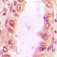Polyclonal Rabbit anti-Human SNRPD2 Antibody (IHC, IF, WB)