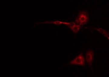 CXCR2 Antibody (phospho-Ser347)