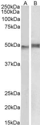 IHC-plus™ Polyclonal Goat anti-Human NCF1 / p47phox / p47 phox Antibody (aa378-390, IHC, IF, WB)