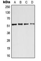 Polyclonal Rabbit anti-Human ATF2 Antibody (N-Terminus, IHC, WB)