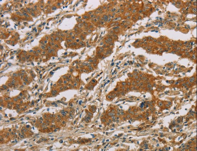 CYP39A1 Antibody