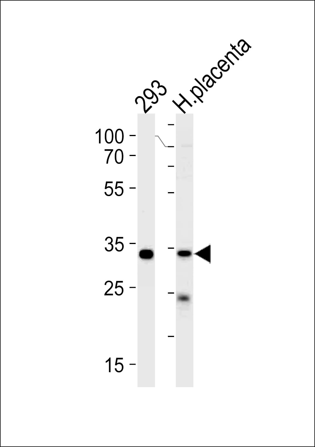 Polyclonal Rabbit anti-Human STUB1 / CHIP Antibody (aa203-231, IHC, WB)