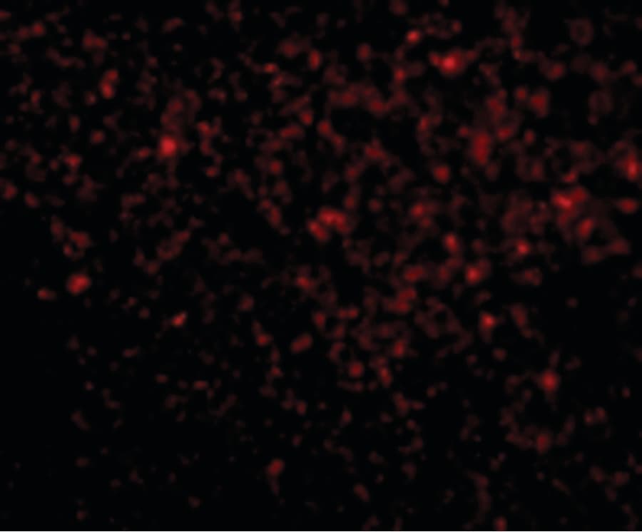 TREX1 Antibody