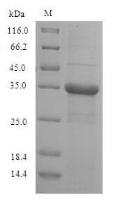 Human RPS10 / Ribosomal Protein S10 (Recombinant 6His-SUMO, N-terminus)