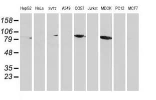CTNNB1 / Beta Catenin Antibody (clone OTI1G1)