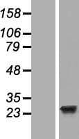 Human EFCAB1 Protein (Over-Expression Lysate Myc-DDK (Flag))