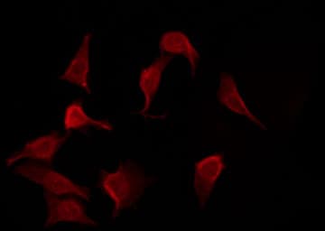 ETK / BMX Antibody (phospho-Tyr566)