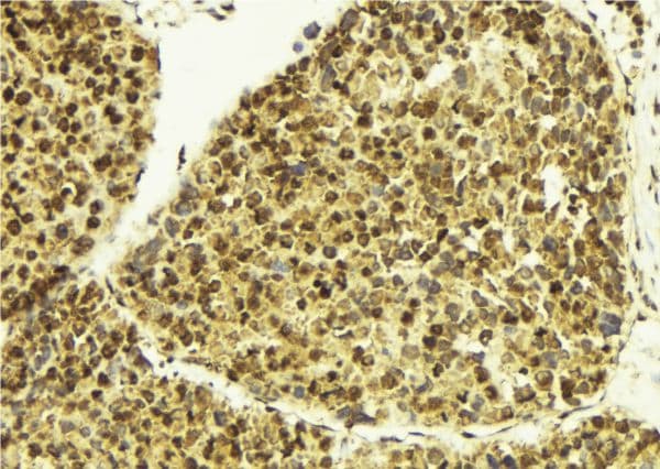 TSEN2 Antibody
