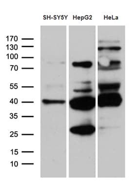 Monoclonal Mouse anti-Human TIMM50 Antibody (clone OTI1E9, aa45-353, WB)