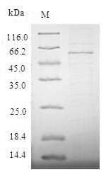 Human STEAP1 / STEAP Protein (Recombinant 10His-SUMO, N-terminus)