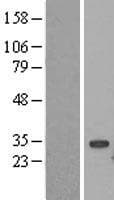 UBE2S / E2 EPF Protein (Over-Expression Lysate Myc-DDK (Flag))