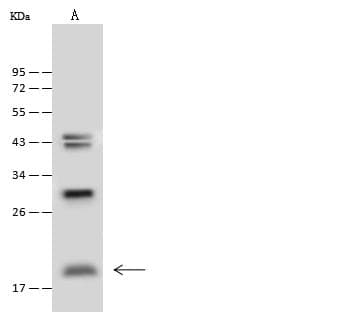CD52 Antibody