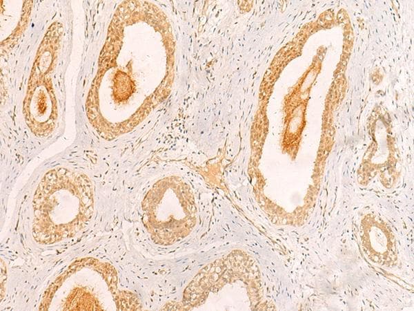 Polyclonal Rabbit anti-Human ZNF580 Antibody (IHC)