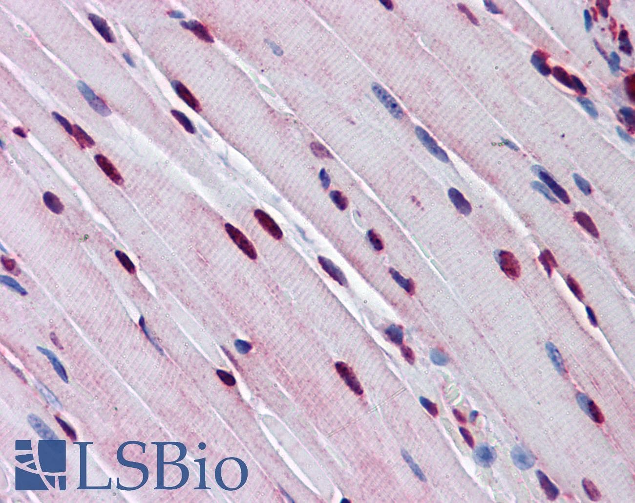 TTF1 / Txn Termination Factor Antibody (aa51-100)