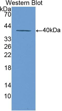 KRT20 / CK20 / Cytokeratin 20 Antibody (aa75-382)