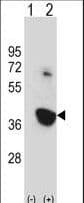 NEK6 Antibody (aa251-280)