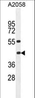HLA-B Antibody (aa182-208)
