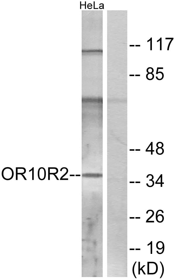 OR10R2 Antibody (aa286-335)