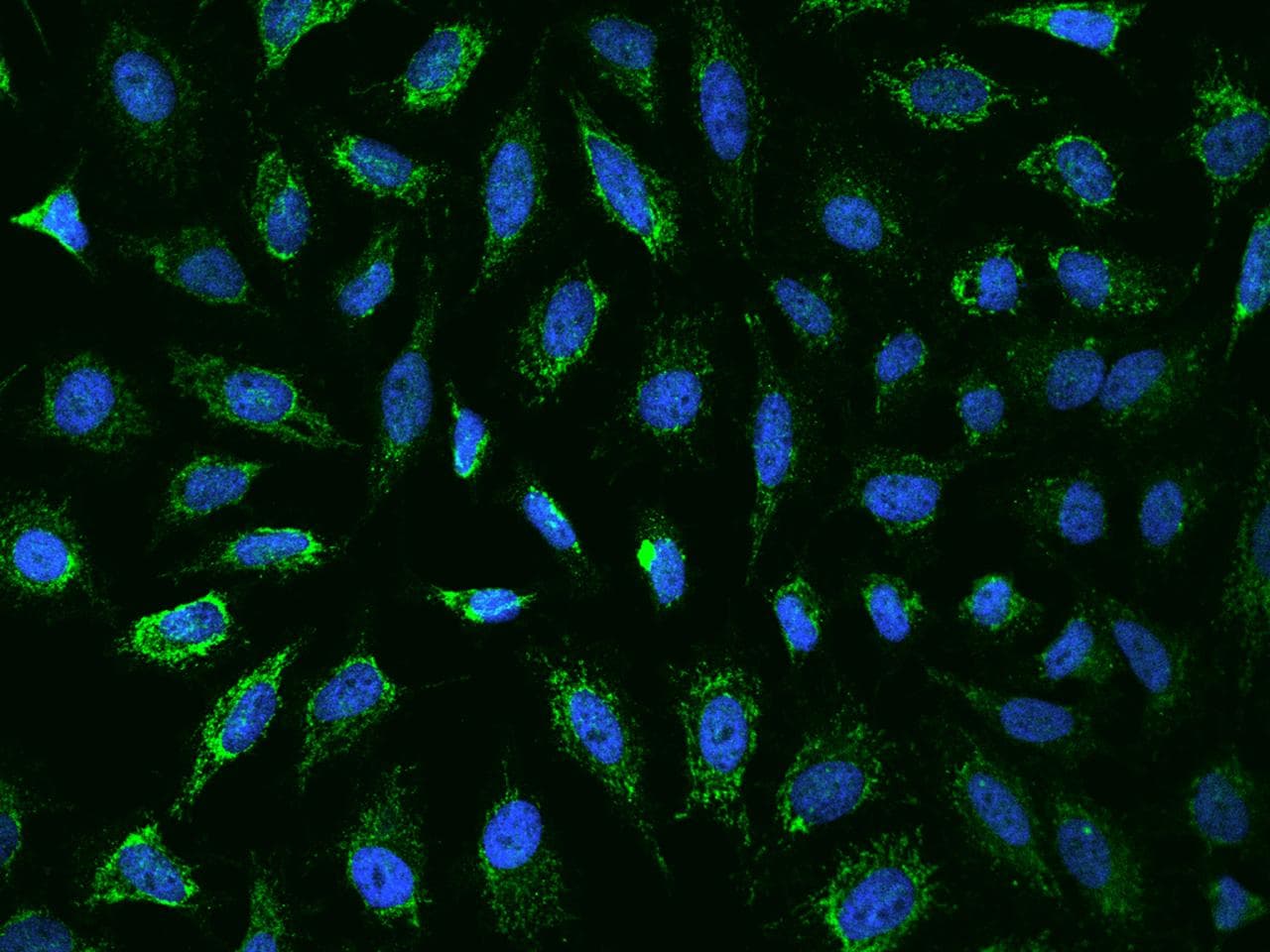 Polyclonal Rabbit anti-Human ANKRD33B Antibody (IHC, IF)