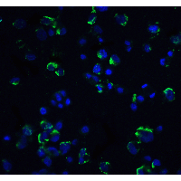Polyclonal Rabbit anti-Human MAP3K14 Antibody (IF, WB)