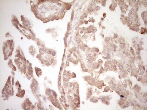 ERBB3 / HER3 Antibody (clone OTI3E10)