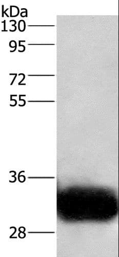 Polyclonal Rabbit anti-Human GPM6A / Glycoprotein M6A Antibody (IHC, WB)