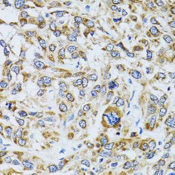 RPN1 / Ribophorin I Antibody