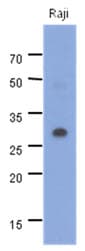 Monoclonal Mouse anti-Human MYD88 Antibody (clone AT22F11, WB)