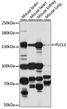 Polyclonal Rabbit anti-Human PLCL1 Antibody (WB)