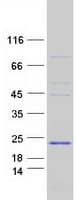 Human PRDM7 Protein (Recombinant Myc-DDK (Flag))
