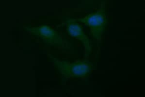 TNF Alpha Antibody (clone OTI1C1)