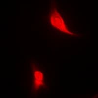Polyclonal Rabbit anti-Human EGLN1 / PHD2 Antibody (IHC, IF, WB)
