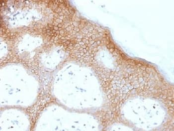 Monoclonal Mouse anti-Human DSG1 / Desmoglein 1 Antibody (clone DSG1/1733, IHC)