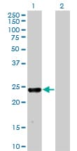 Monoclonal Mouse anti-Human MXI1 / MAD2 Antibody (clone 1F3, WB)