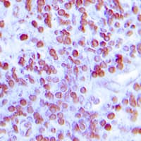 Polyclonal Rabbit anti-Human MNDA Antibody (C-Terminus, IHC, WB)