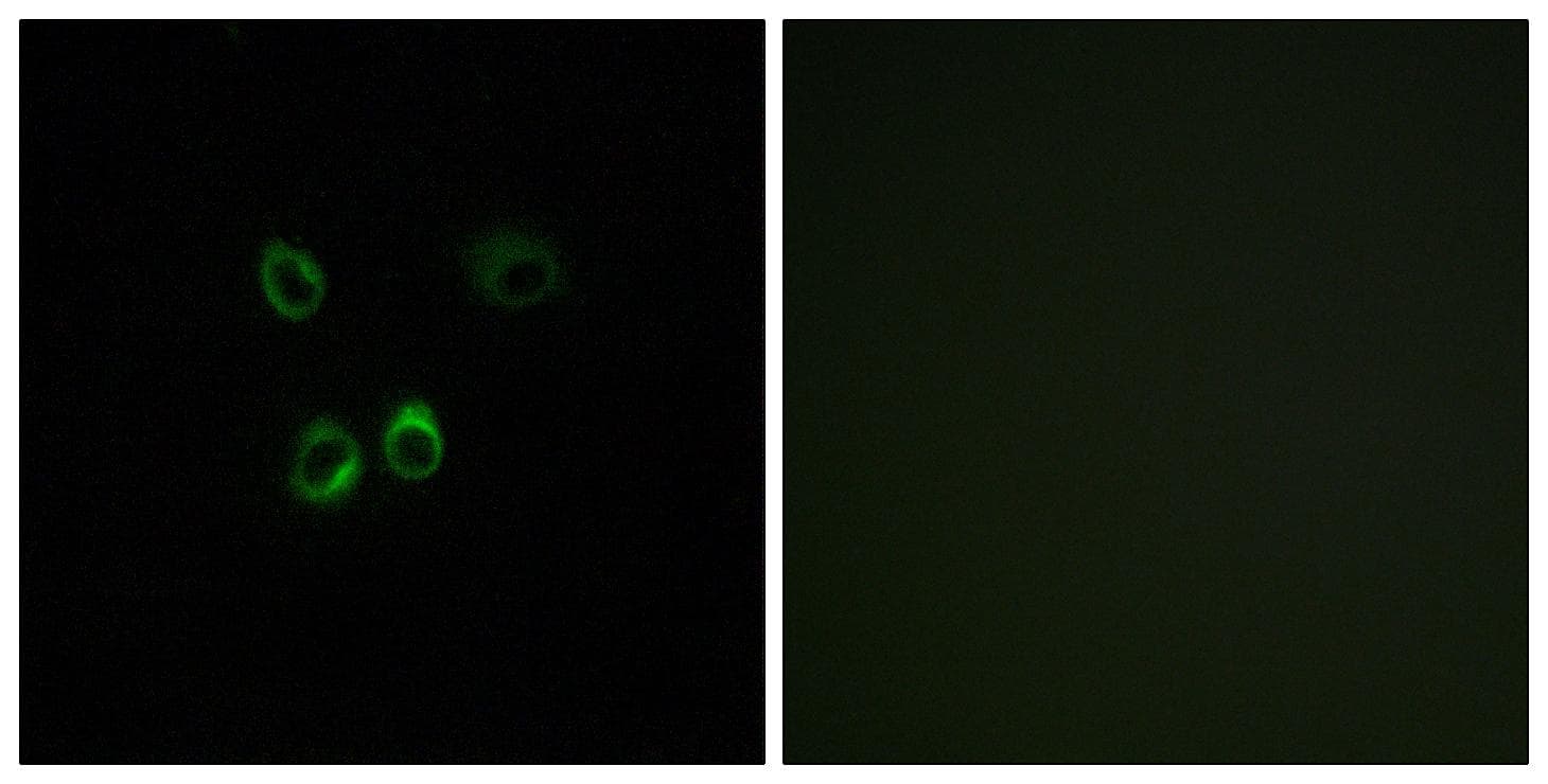Polyclonal Rabbit anti-Human RGR Antibody (IHC, IF)