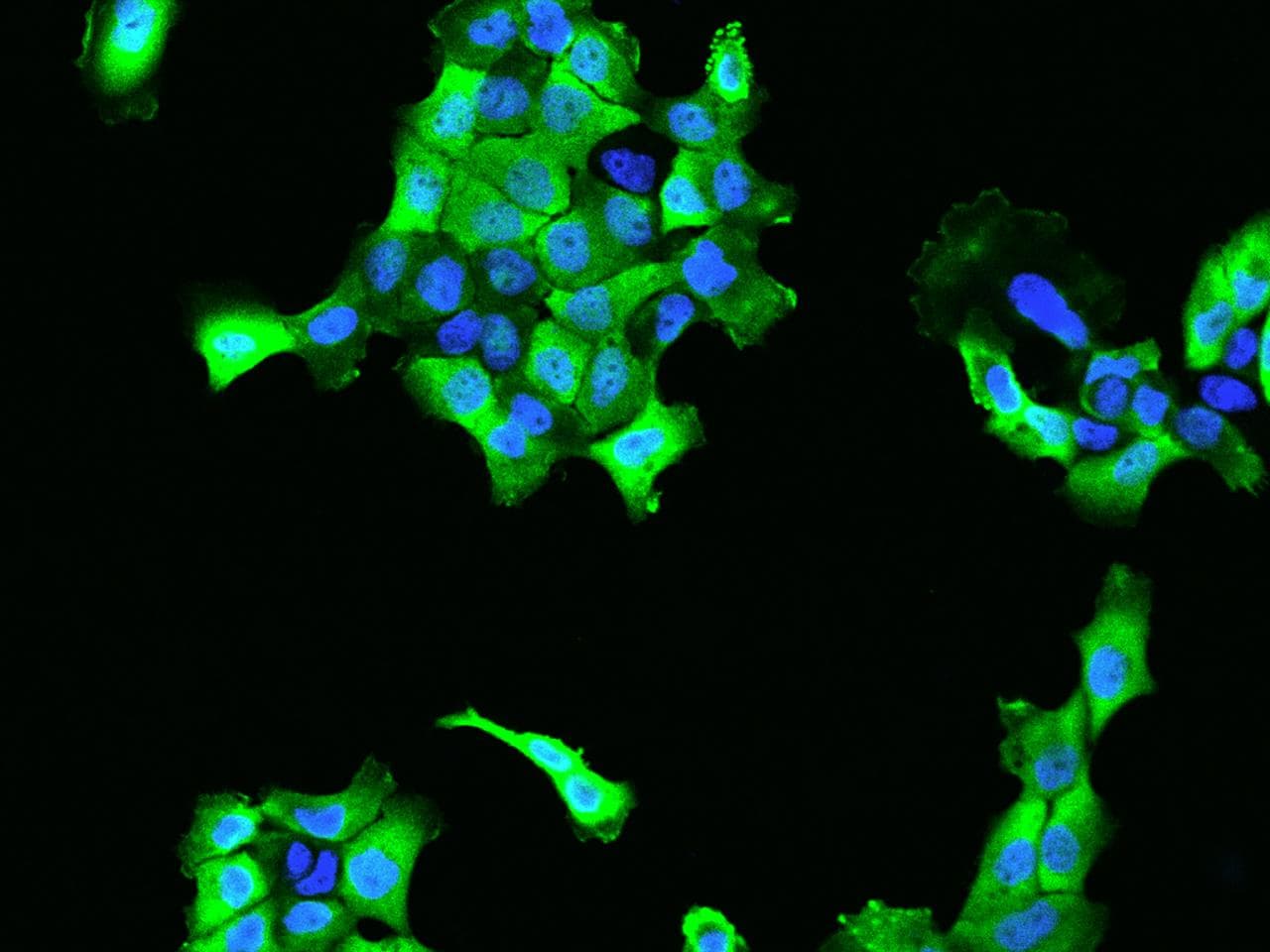 Polyclonal Rabbit anti-Human CACYBP Antibody (IHC, IF, WB)