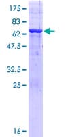 Human PHF20L1 Protein (Recombinant GST)