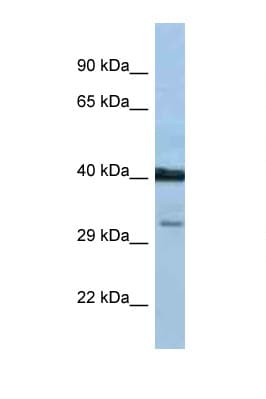 Polyclonal Rabbit anti-Human Prostaglandin D2 Receptor Antibody (aa238-287, WB)