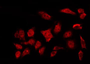 NR3C1/Glucocorticoid Receptor Antibody (phospho-Ser226)