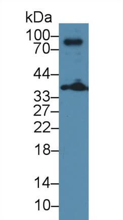 LAT Antibody (aa30-237)