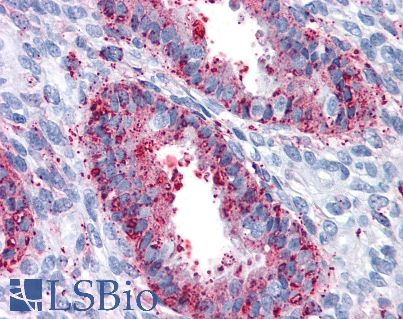 IHC-plus™ ENTPD2 Antibody (Internal)