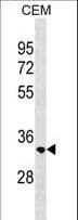 RAB40C Antibody (aa122-148)