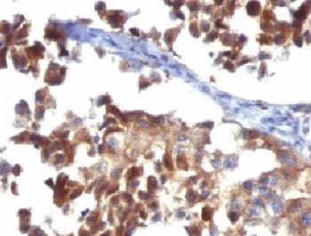 CD63 Antibody (clone LAMP3/968, Ready-to-Use)