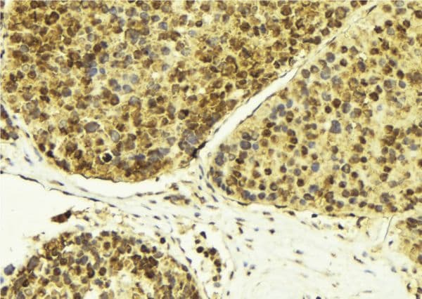Polyclonal Rabbit anti-Human RBM5 / G15 Antibody (IHC, IF, WB)