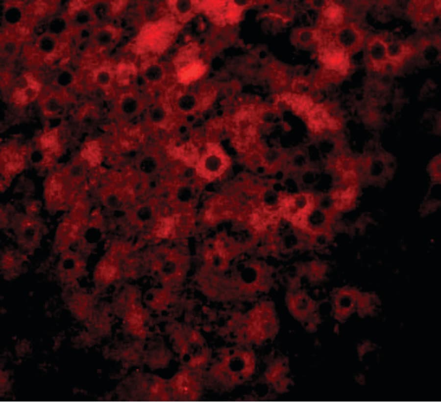 IHC-plus™ Polyclonal Rabbit anti-Human KDM3B / JMJD1B Antibody (IHC, IF, WB)