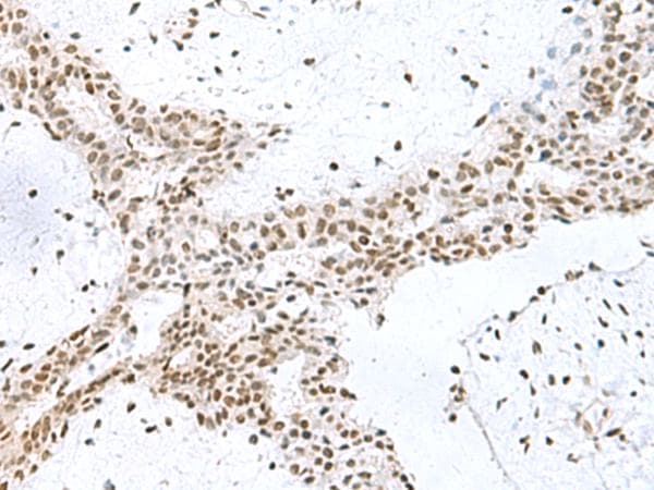 KIAA0020 / PEN Antibody