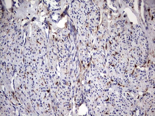 LGALS3 / Galectin 3 Antibody (clone OTI1C7)