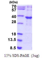 Human P5CR2 / PYCR2 Protein (Recombinant His)