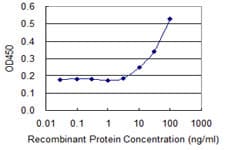 IHC-plus™ CYB5A / Cytochrome b5 Antibody (clone 4C2)